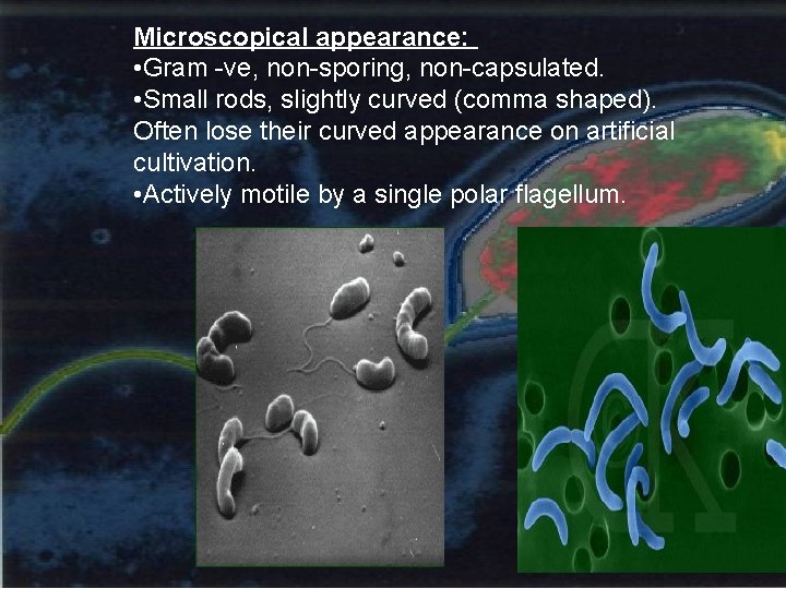 Microscopical appearance: • Gram -ve, non-sporing, non-capsulated. • Small rods, slightly curved (comma shaped).