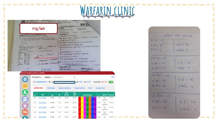 Warfarin clinic mg/wk Vestibulum congue 20 