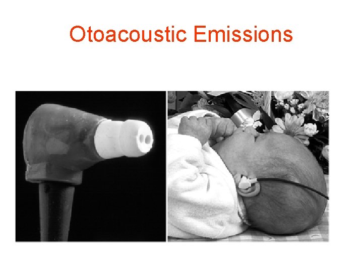 Otoacoustic Emissions 