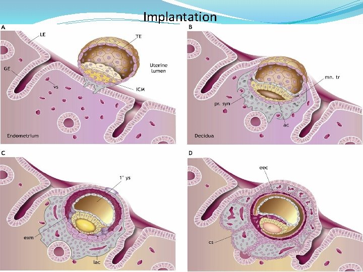 Implantation 