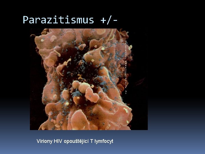 Parazitismus +/- Viriony HIV opouštějící T lymfocyt 