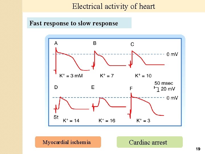 Electrical activity of heart Fast response to slow response Myocardial ischemia Cardiac arrest 19