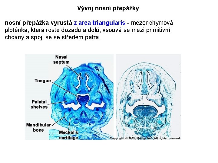 Vývoj nosní přepážky nosní přepážka vyrůstá z area triangularis - mezenchymová ploténka, která roste