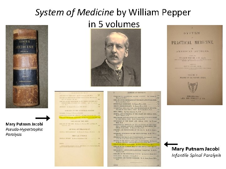 System of Medicine by William Pepper in 5 volumes • . Mary Putnam Jacobi