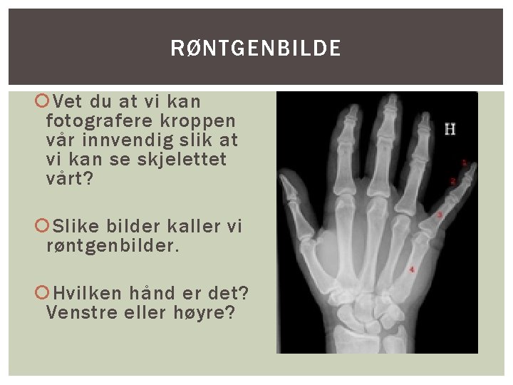 RØNTGENBILDE Vet du at vi kan fotografere kroppen vår innvendig slik at vi kan