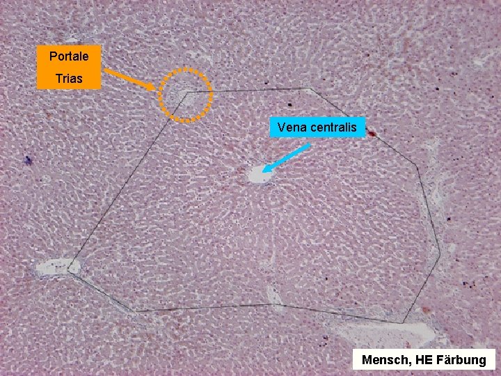 Portale Trias Vena centralis Mensch, HE Färbung Portale Trias Vena centralis Mensch, HE Färbung