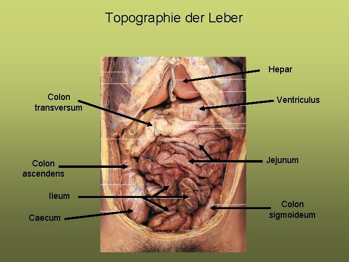 Topographie der Leber Hepar Colon transversum Colon ascendens Ileum Caecum Ventriculus Jejunum Colon sigmoideum Topographie der Leber Hepar Colon transversum Colon ascendens Ileum Caecum Ventriculus Jejunum Colon sigmoideum