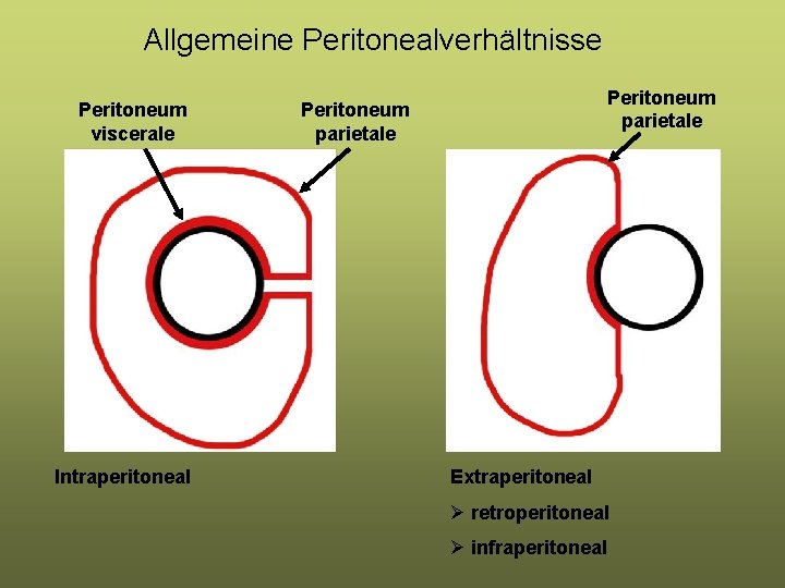 Allgemeine Peritonealverhältnisse Peritoneum viscerale Intraperitoneal Peritoneum parietale Extraperitoneal Ø retroperitoneal Ø infraperitoneal Allgemeine Peritonealverhältnisse Peritoneum viscerale Intraperitoneal Peritoneum parietale Extraperitoneal Ø retroperitoneal Ø infraperitoneal