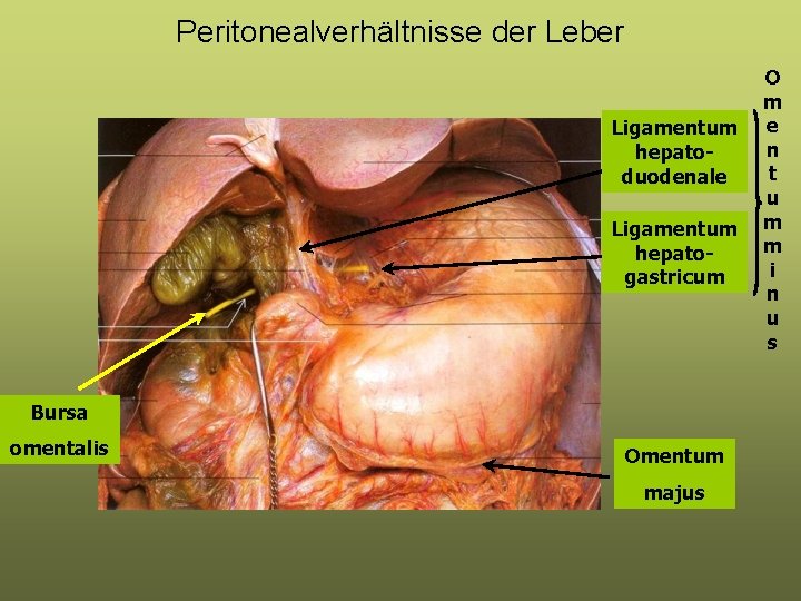 Peritonealverhältnisse der Leber Ligamentum hepatoduodenale Ligamentum hepatogastricum Bursa omentalis Omentum majus O m e Peritonealverhältnisse der Leber Ligamentum hepatoduodenale Ligamentum hepatogastricum Bursa omentalis Omentum majus O m e