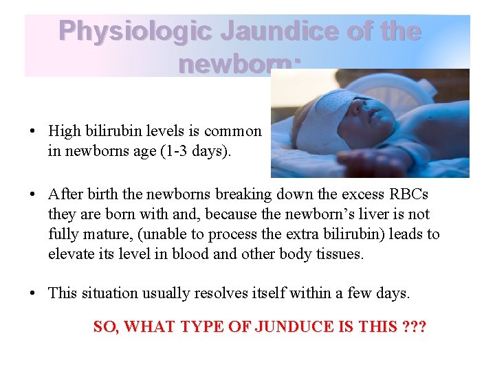 Physiologic Jaundice of the newborn: • High bilirubin levels is common in newborns age