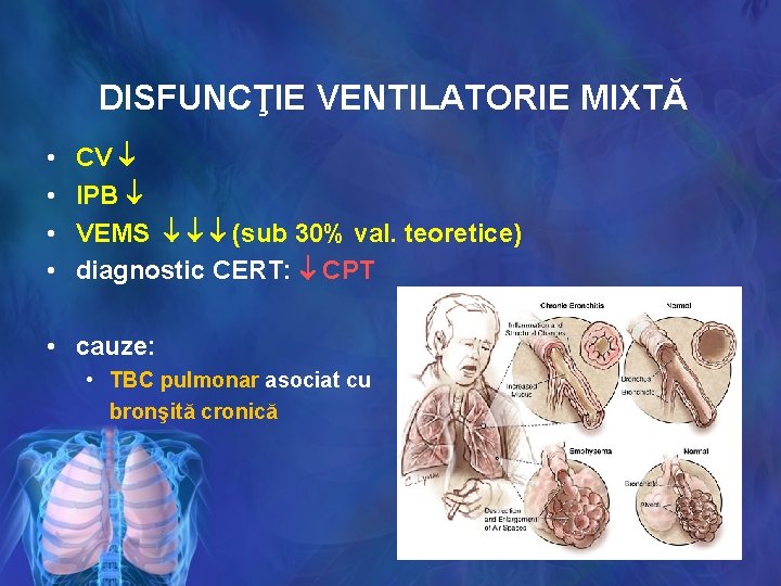 DISFUNCŢIE VENTILATORIE MIXTĂ • • CV IPB VEMS (sub 30% val. teoretice) diagnostic CERT: