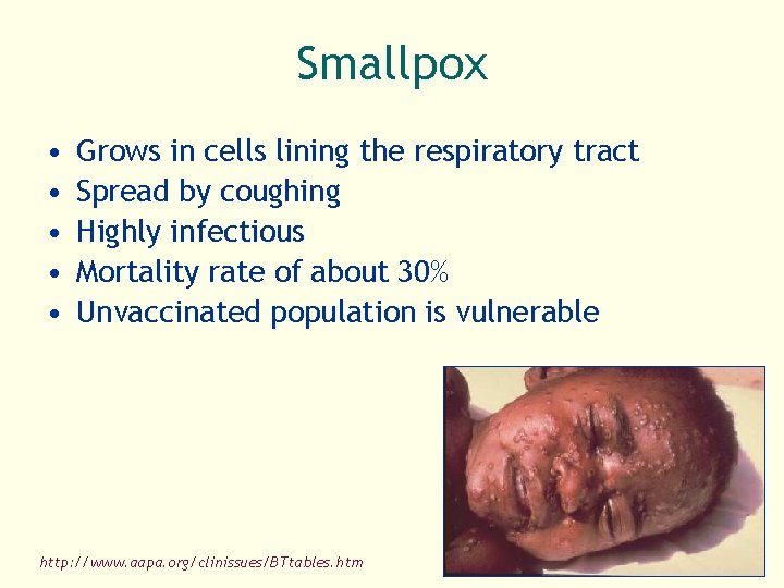 Smallpox • • • Grows in cells lining the respiratory tract Spread by coughing