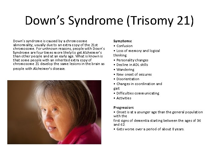 Down’s Syndrome (Trisomy 21) Down’s syndrome is caused by a chromosome abnormality, usually due