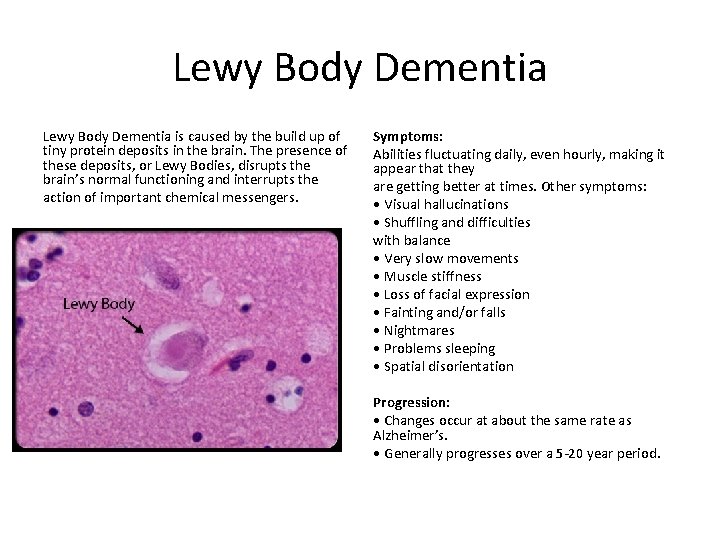 Lewy Body Dementia is caused by the build up of tiny protein deposits in