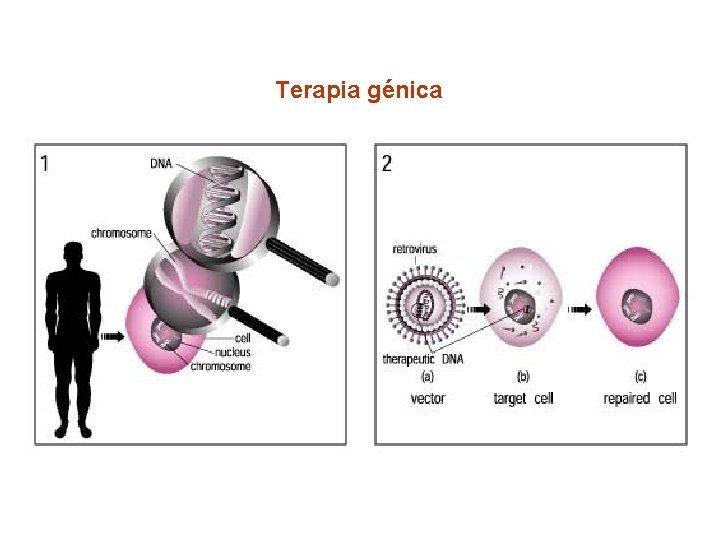 Terapia génica 