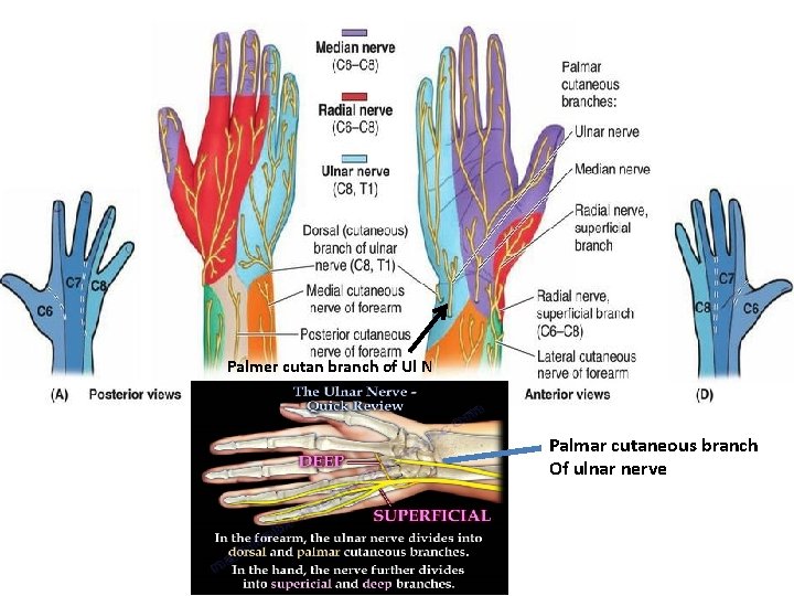 Palmer cutan branch of Ul N Palmar cutaneous branch Of ulnar nerve 