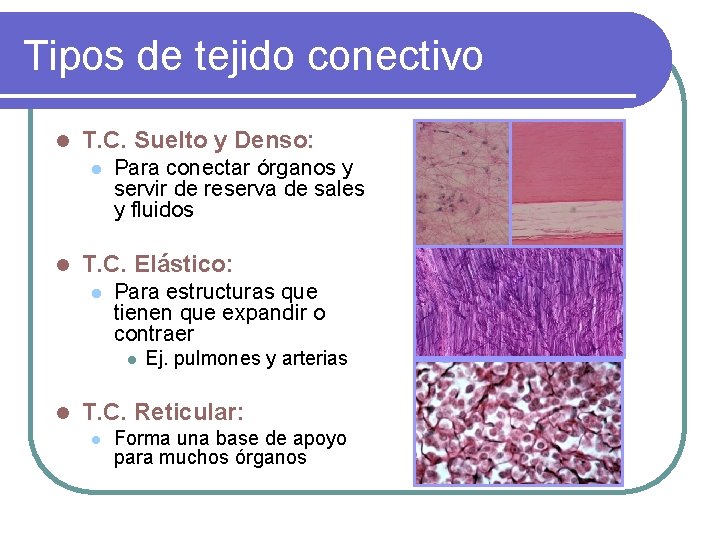 Tipos de tejido conectivo l T. C. Suelto y Denso: l l Para conectar