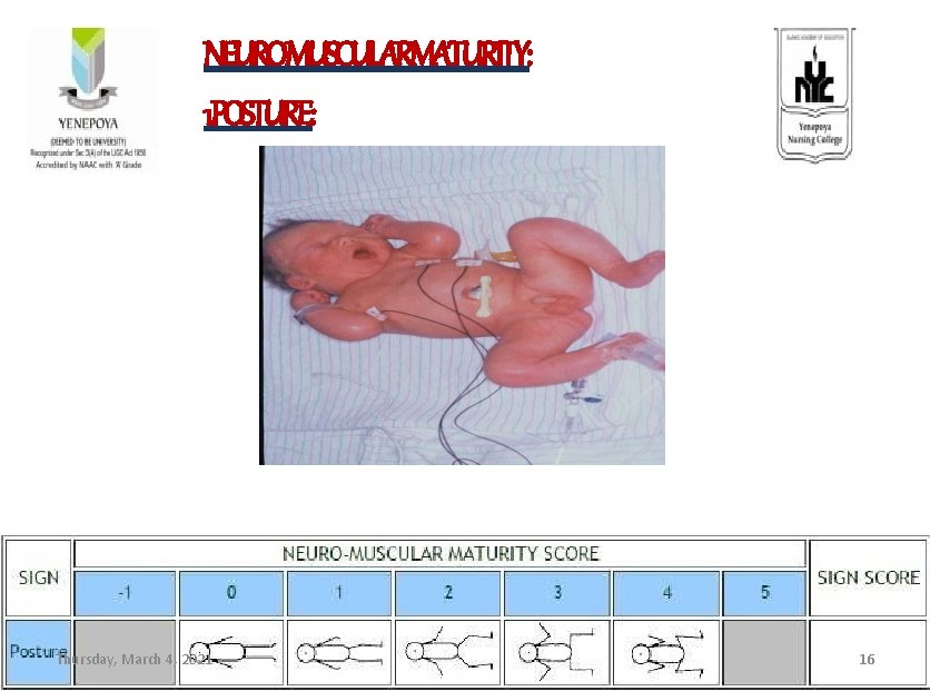 NEUROMUSCULARMATURITY: 1. POSTURE: Thursday, March 4, 2021 16 