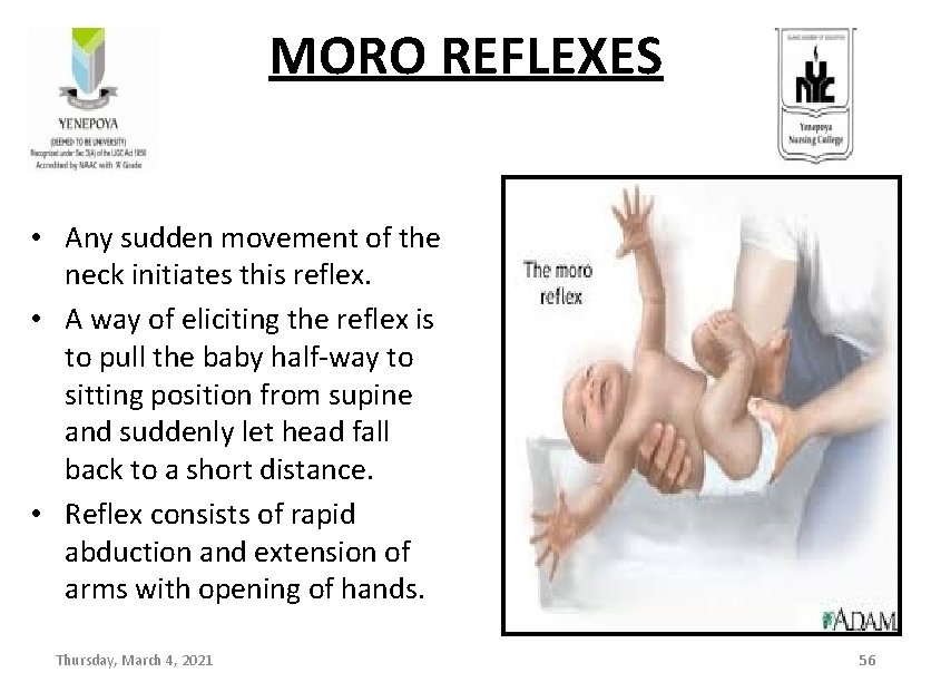 MORO REFLEXES • Any sudden movement of the neck initiates this reflex. • A