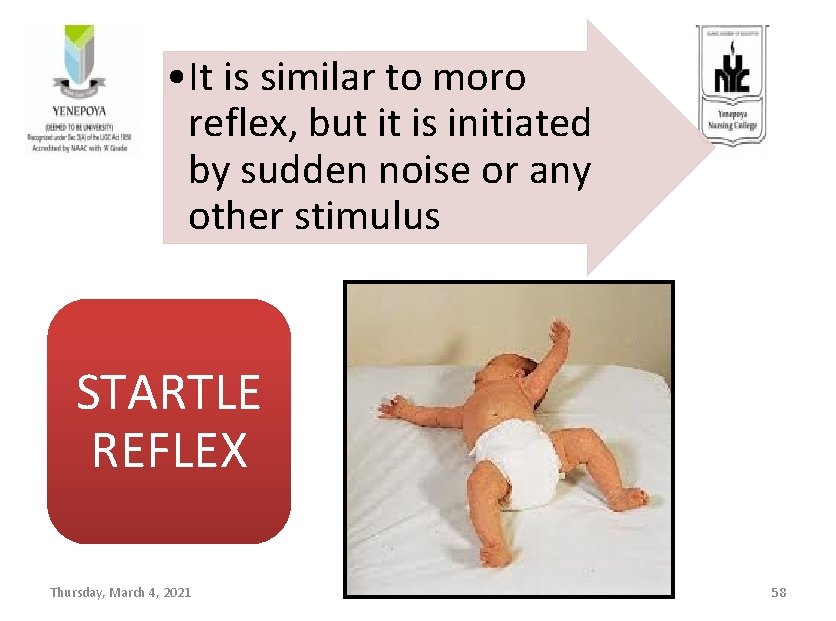  • It is similar to moro reflex, but it is initiated by sudden