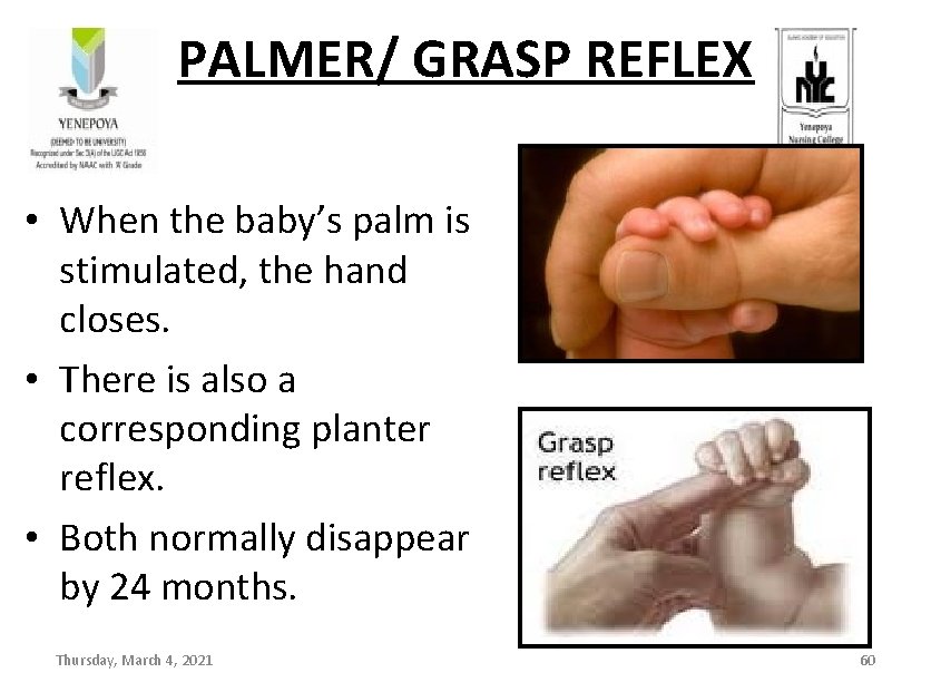 PALMER/ GRASP REFLEX • When the baby’s palm is stimulated, the hand closes. •