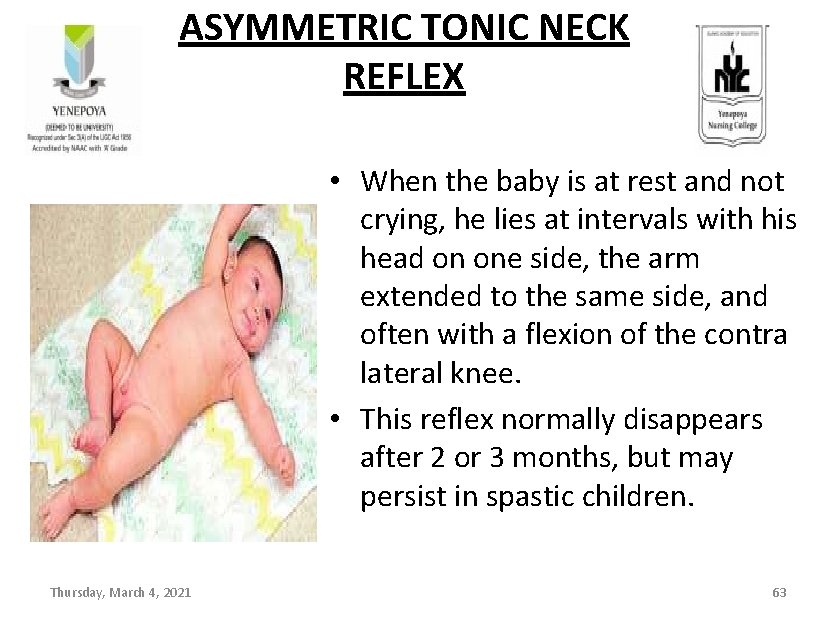 ASYMMETRIC TONIC NECK REFLEX • When the baby is at rest and not crying,