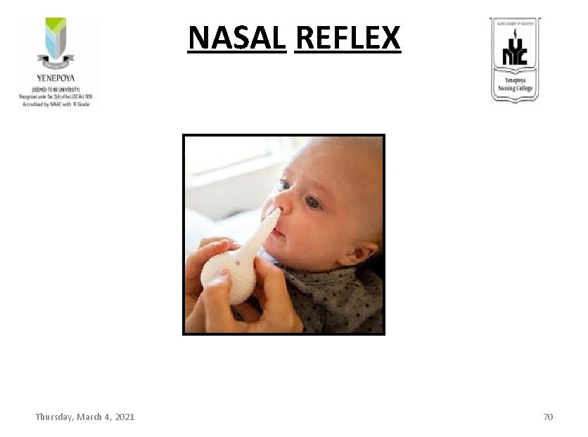 NASAL REFLEX Thursday, March 4, 2021 70 