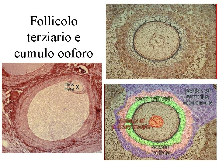 Follicolo terziario e cumulo ooforo 