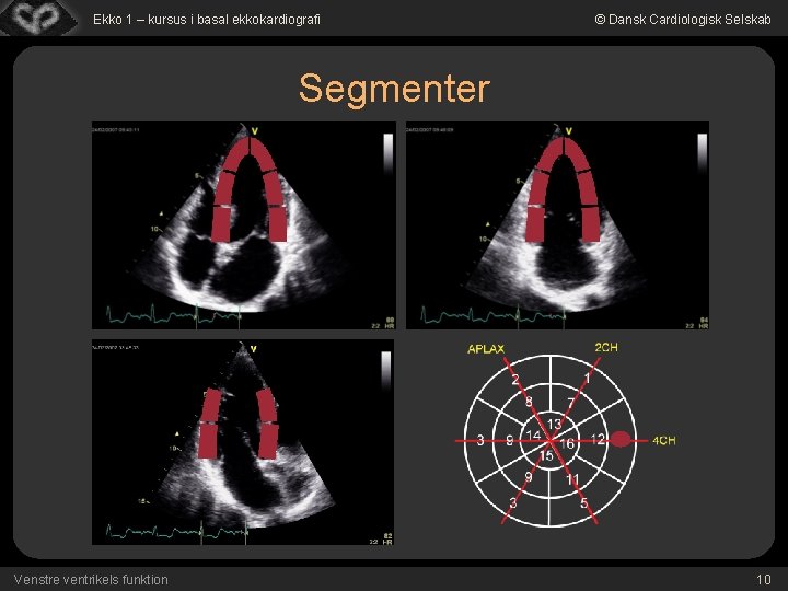 Ekko 1 – kursus i basal ekkokardiografi © Dansk Cardiologisk Selskab Segmenter Venstre ventrikels