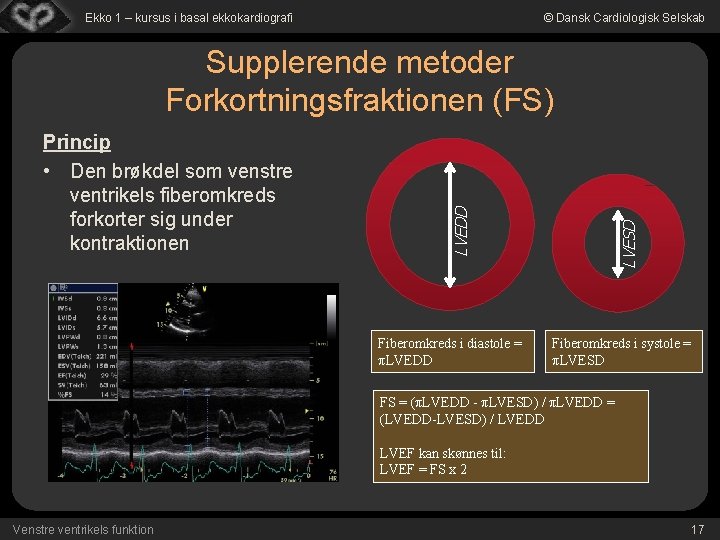 Ekko 1 – kursus i basal ekkokardiografi © Dansk Cardiologisk Selskab Fiberomkreds i diastole