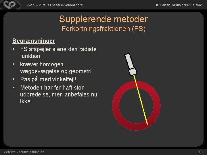 Ekko 1 – kursus i basal ekkokardiografi © Dansk Cardiologisk Selskab Supplerende metoder Forkortningsfraktionen