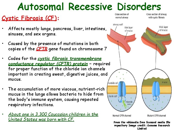 Autosomal Recessive Disorders Cystic Fibrosis (CF): • Affects mostly lungs, pancreas, liver, intestines, sinuses,