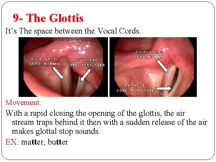 9 - The Glottis It’s The space between the Vocal Cords. Movement: With a 9 - The Glottis It’s The space between the Vocal Cords. Movement: With a