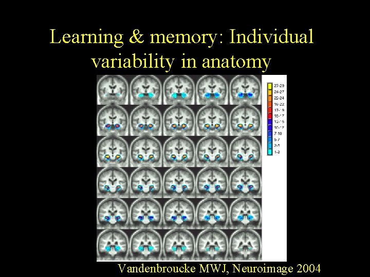 Learning & memory: Individual variability in anatomy Vandenbroucke MWJ, Neuroimage 2004 Learning & memory: Individual variability in anatomy Vandenbroucke MWJ, Neuroimage 2004