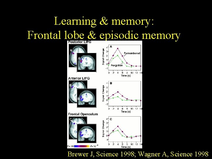 Learning & memory: Frontal lobe & episodic memory Brewer J, Science 1998; Wagner A, Learning & memory: Frontal lobe & episodic memory Brewer J, Science 1998; Wagner A,