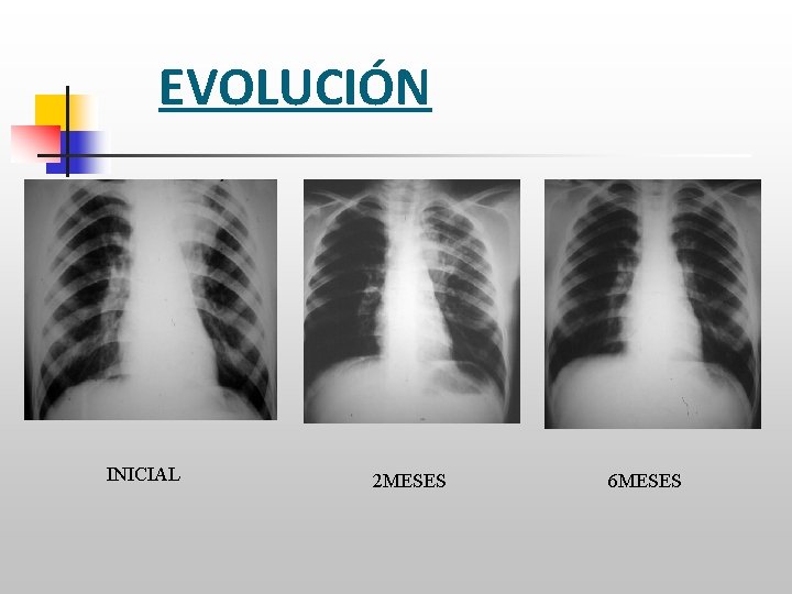 EVOLUCIÓN INICIAL 2 MESES 6 MESES 