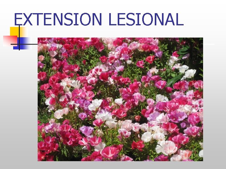 EXTENSION LESIONAL MCC 