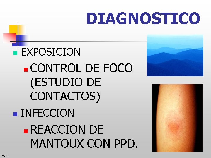 DIAGNOSTICO n EXPOSICION n n INFECCION n MCC CONTROL DE FOCO (ESTUDIO DE CONTACTOS)