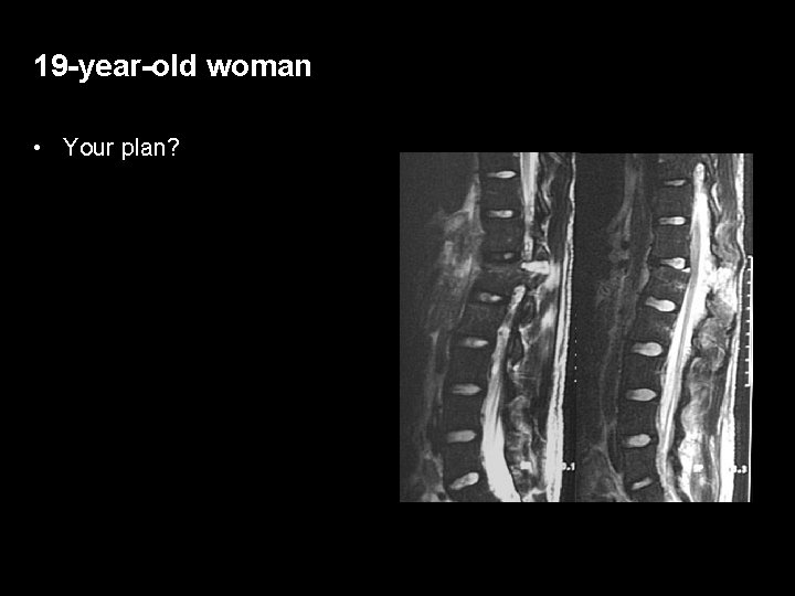 19 -year-old woman • Your plan? 