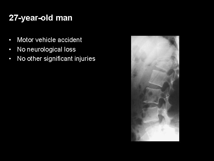 27 -year-old man • Motor vehicle accident • No neurological loss • No other