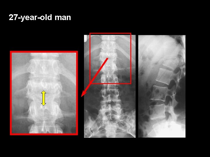 27 -year-old man 