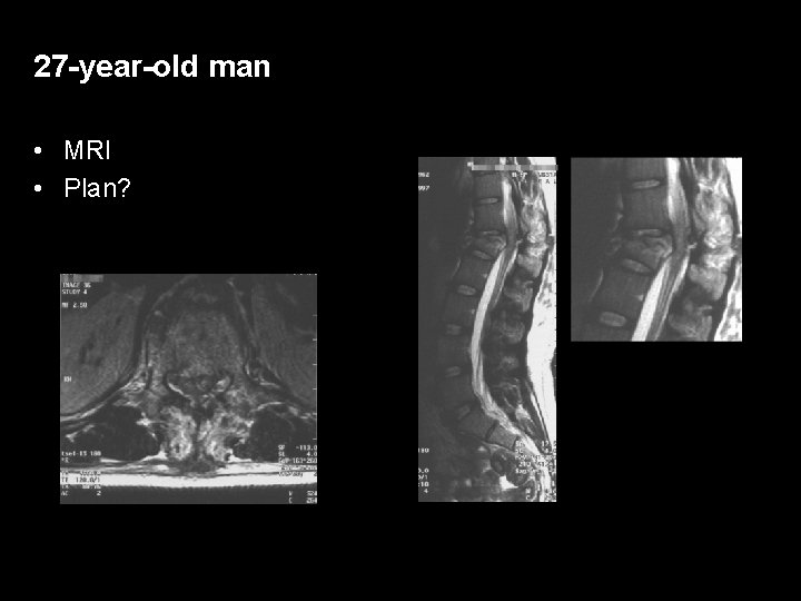 27 -year-old man • MRI • Plan? 