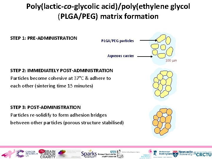 Poly(lactic-co-glycolic acid)/poly(ethylene glycol (PLGA/PEG) matrix formation STEP 1: PRE-ADMINISTRATION PLGA/PEG particles Aqueous carrier STEP