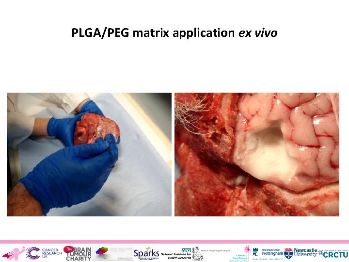 PLGA/PEG matrix application ex vivo 