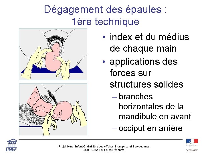 Dégagement des épaules : 1ère technique • index et du médius de chaque main