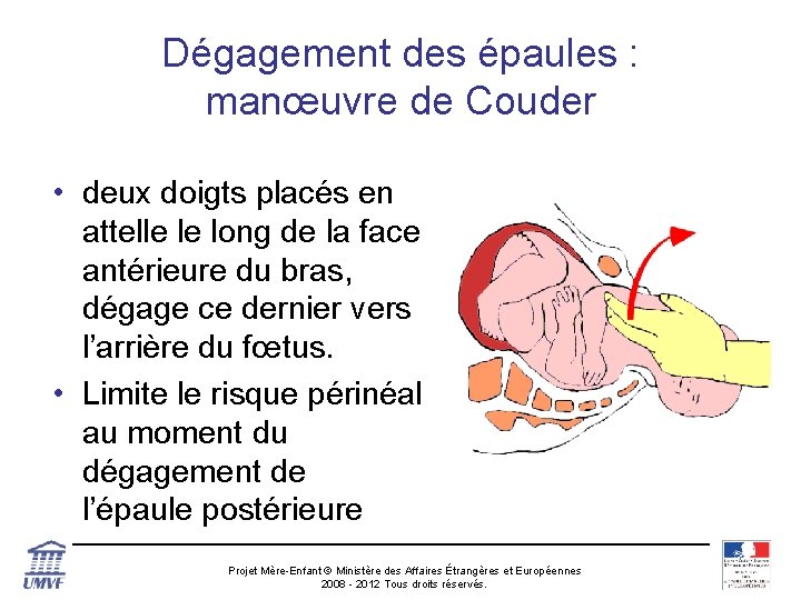 Dégagement des épaules : manœuvre de Couder • deux doigts placés en attelle le