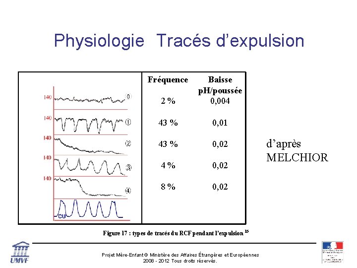 Physiologie Tracés d’expulsion Fréquence 2 % Baisse p. H/poussée 0, 004 43 % 0,