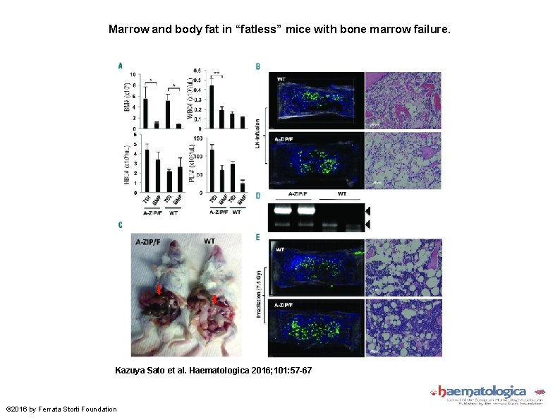 Marrow and body fat in “fatless” mice with bone marrow failure. Kazuya Sato et
