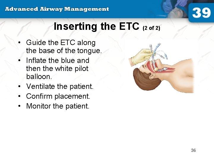 Inserting the ETC (2 of 2) • Guide the ETC along the base of