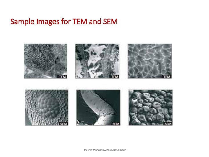 Sample Images for TEM and SEM Electron Microscopy, Dr. Shilpee Sachar  Sample Images for TEM and SEM Electron Microscopy, Dr. Shilpee Sachar